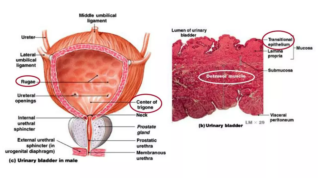 The relationship between diabetes and muscle spasms in the bladder and urinary tract